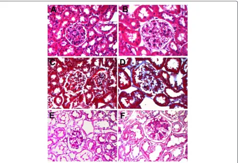 Figure 4 Glomerular changes in db/db diabetic mice. Panels A, C and E are controls, and panels B, D and F are from db/db mice withdiabetic nephropathy