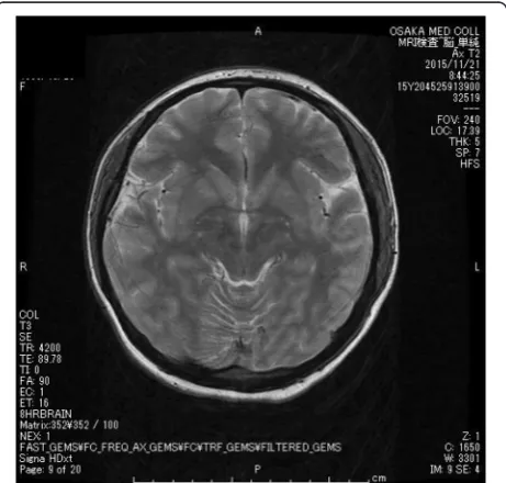 Fig. 1 Head CT image with no remarkable findings