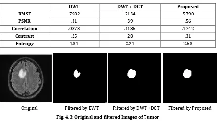 Fig. 4.3: Original and filtered Images of Tumor 