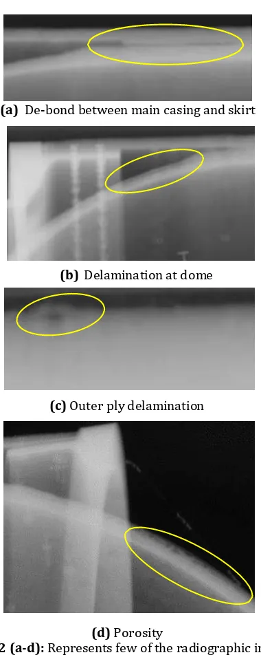 Fig – 12 (a-d): Represents few of the radiographic images of high dB loss zone 