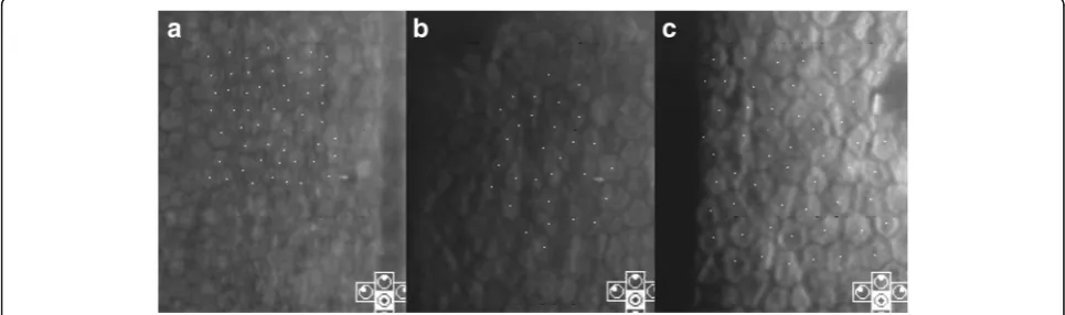 Fig. 1 Case 1: serial follow-up of specular microscopy. At the initial visit, the corneal endothelial count in the left eye was 2141 cells/mm2 (a)