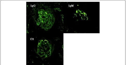 Figure 1 Light microscopy findings. a) Several crescents with focal endocapillary hypercellularity are visible in the glomeruli (Periodic acid-Schiff,×200 original magnification)