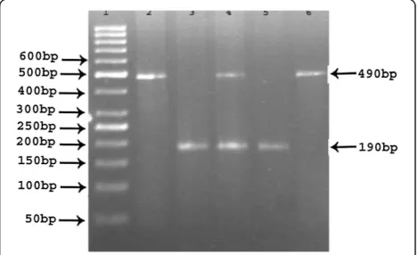 Figure 1 Identification of ACE I/D polymorphism in 2.5%agarose gel electrophoresis. Legend: Lane 1: 50bp DNA Marker/Ladder