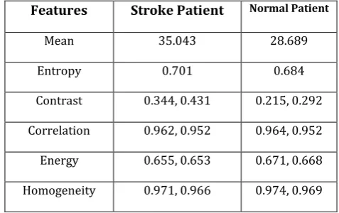 Table -1: Feature Database of Stroke and NormalPatient 