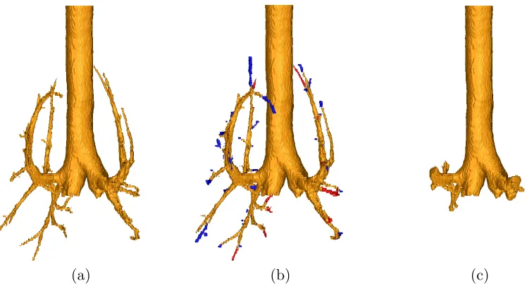 Figure 2.4: Surface rendering of an example result using the proposed method. (a) Seg-mented airway using our approach