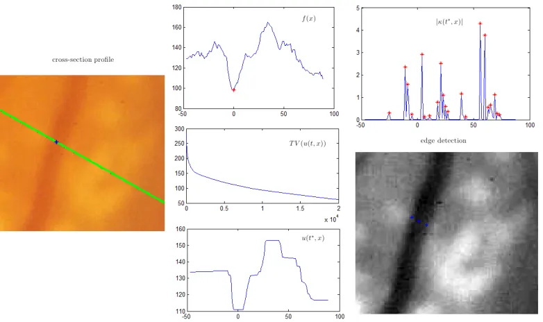 Figure 6.11: Example 3: edge detection for fundus image