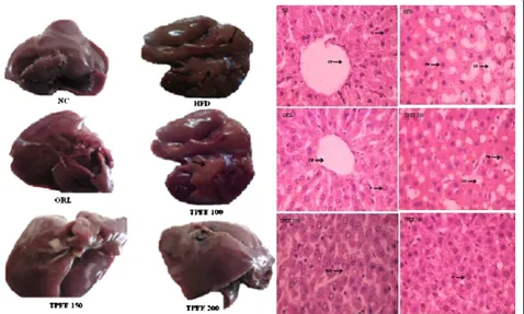 Figure 5 Effect of TPEE on liver morphology and histopathology in control and HFD-fed rats