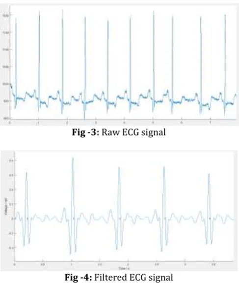 Fig -3: Raw ECG signal 