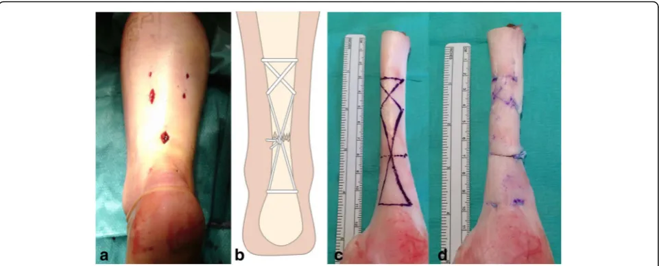 Fig. 1 a The cosmetic and wound size of minimally invasive repair prior to skin closure, b a schematic of repair performed using the combination of amodified Bunnell suture proximally and a Kessler suture distally