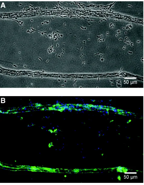Figure 2.2. Removal of cords from PDMS template. Phase contrast (A) and 