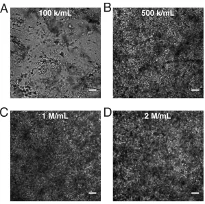 Figure 2.6 Networking behavior of e.End2 cells in collagen gels. Brightfield 