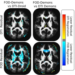Figure 3.6: Statistical maps determined by four t-tests, performed to identify regions wherethe registration methods yield diﬀerent FOD and DTI residuals.Representative slices,thresholded at an FDR correct p-score of 0.001, are shown