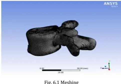 Fig. 5.4 Lumbar spine bottom view 