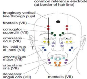 Figure-2: Electrode location for measuring facial EMG activity 