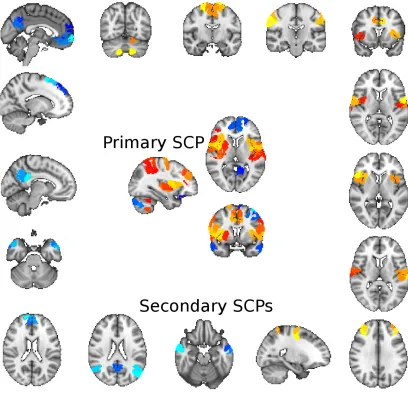 Figure 2.16: A primary SCP and some of its associated secondary SCPs computed from thePNC dataset using GraSP parcels.