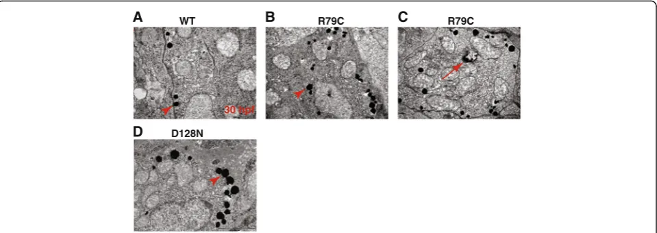 Fig. 4 Aggregation susceptibility of mutant GFAPs can be assessed using zebrafish. a-d Zebrafish embryos at one-cell stage were microinjectedwith expression plasmids encoding WT (a), p.Arg79Cys GFAP (b and c), or p.Asp128Asn (d), and imaged at 30 hpf with 