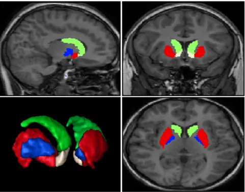 Figure 1: Posterior lateralized view of a 3D rendering of the manual segmentation for the eight ROIs (four left and four right) as they appear in one of the subjects in study, along with an orthographic view of the same regions in their corresponding brain