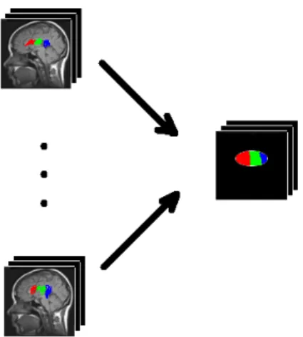 Figure 4: Process of obtaining the probability map