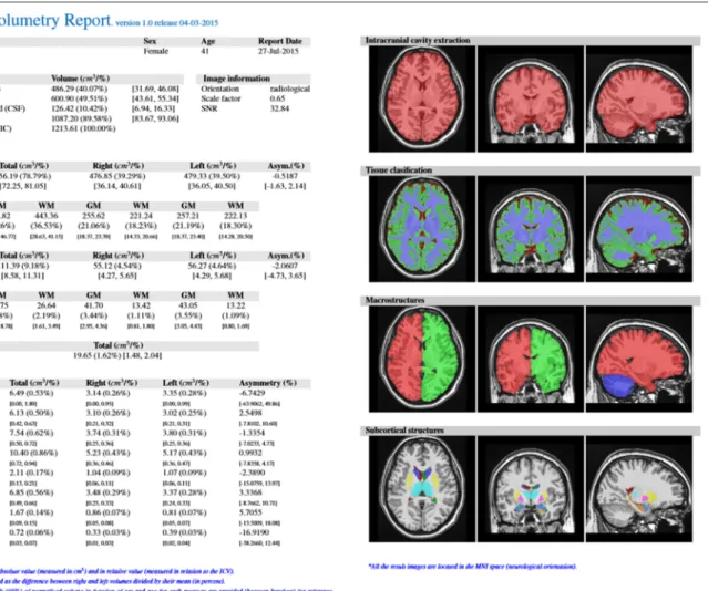FIGURE 4 | Example of volBrain pdf report.