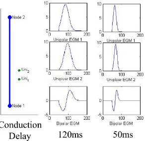 Figure 3.4: The inﬂuence of conduction velocity and probe conﬁguration on the EGMmorphology