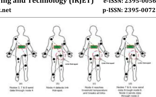 Figure 3.1: WBAN Body Area Network path selection   