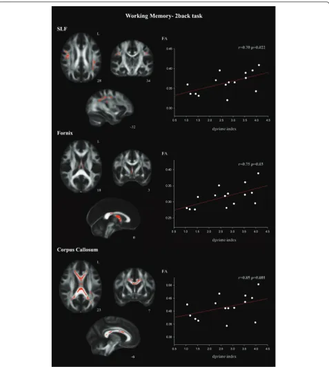 Figure 2 ROI correlations with d-prime 2-back index in the TBI group for the SLF, fornix, and corpus callosum ROIs (TFCE, p < 0.05FWE-corrected)
