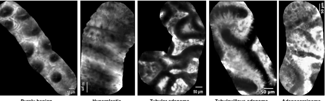 Figure 2: Examples of annotated endomicroscopic videos.