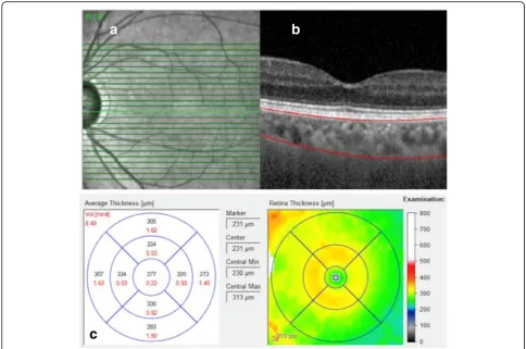 Fig. 1 Enhanced depth imaging-optical coherence tomography (EDI-OCT) of the macular region.scleral-uveal junction; a 31 B-scans of the macular region; b Marked c The choroidal volume [mm3] (marked in red) and thickness [μm] (marked in black) measurements presented separatelyfor 9 Early Treatment Diabetic Retinopathy Study (ETDRS) subfields
