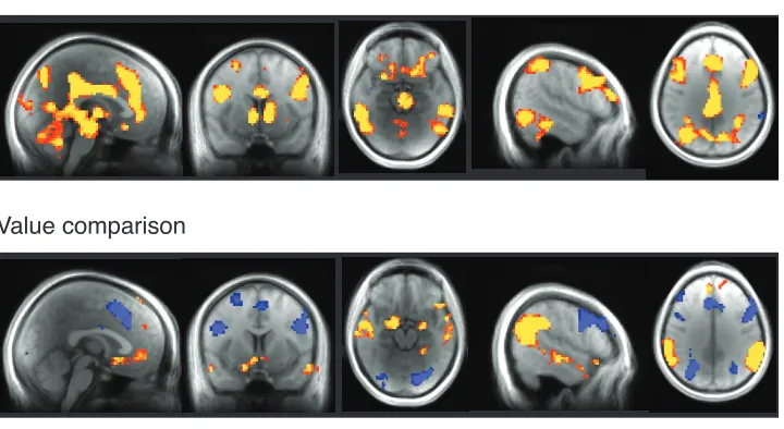 Figure 5. Whole brain analysis of subjective value and value comparison. The top panel shows 