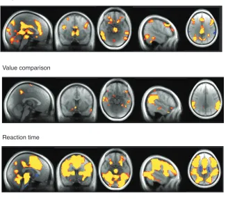 Figure 7. Whole brain analysis of value and response demands. Contrasts of subjective value 