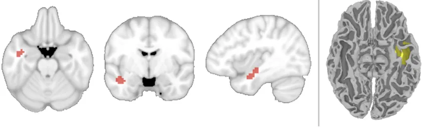 Figure 2: Location for searchlights with above-chance decoding of object identity while 