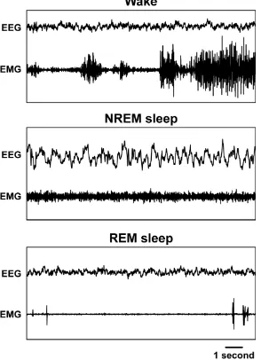 Figure 1.2.  Polysomnography recordings in the cat.  EEG activity during waking is low 