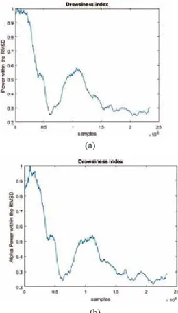 Figure 2.  Data acquisition and feature extraction in both time  and frequency domain.