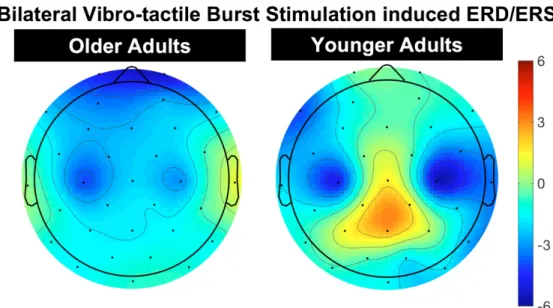 Figure 7. Bilateral vibro-tactile stimulation ERD/ERS topoplot averaged over -0.4 to - -0.1s in response to the 200ms bilateral stimulation at -1s