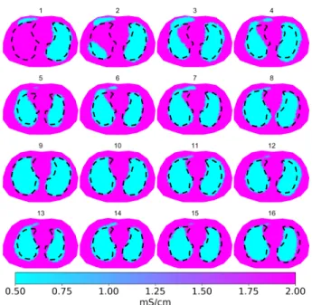 Fig. 7. Case 3: Lung imaging with modeling errors caused by non- non-homogeneous background