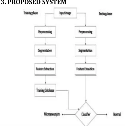 Figure 1:Process flow of Diabetic Retinopathy   
