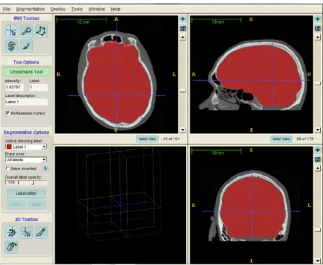 Figure 6. Binary segmentation mask visualized in ITK-Snap before export.