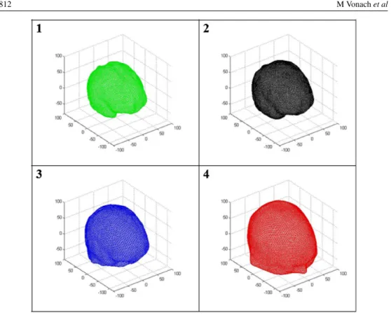 Figure 9. Example of four layer mesh—(1) Brain. (2) CSF. (3) Skull. (4) Scalp.