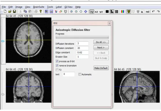 Figure 3. BrainSuite settings for skull stripping.