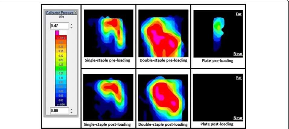 Fig. 3 Compressive force over 10 min constructs before and after loading. SS: Single-staple, DS: Double-staple, PL: Plate