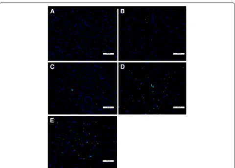 Fig. 9 Graphs illustrating the TUNEL assay results at 6 weeks post-injuryThe numbers of apoptosis-positive cells were significantly decreased inthe rabbits subjected to the 50-underwent rostral compression release compared with the rabbits thatunderwent PCD.in the control, 40-μl PRD, 40-μl PCD, 50-μl PRD and 50-μl PCD groups.μl compression injury when they initially ****p < 0.0001, $$$$p < 0.0001