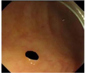 Fig. 11. Endoscope Image Fig. 12. Mask Image