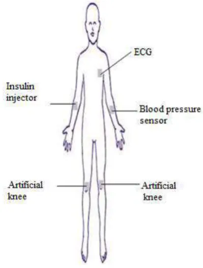 Fig -1: Overview of WBAN [1].  