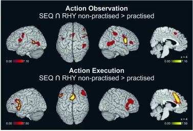 Figure 5. Conjunctions between sequence and rhythm tasks. Conjunction between spatial sequence and For Peer Review(160 mm3)