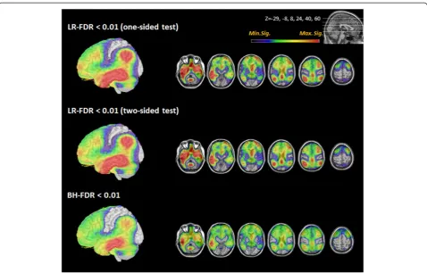 Table 2 Total number of voxels in the whole brain withsignificant hypometabolism at different threshold levels