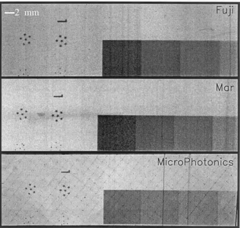 Fig. 5 is a qualitative comparison of the three detectors using a section of a digital  mammogra-phy phantom from the International Digital