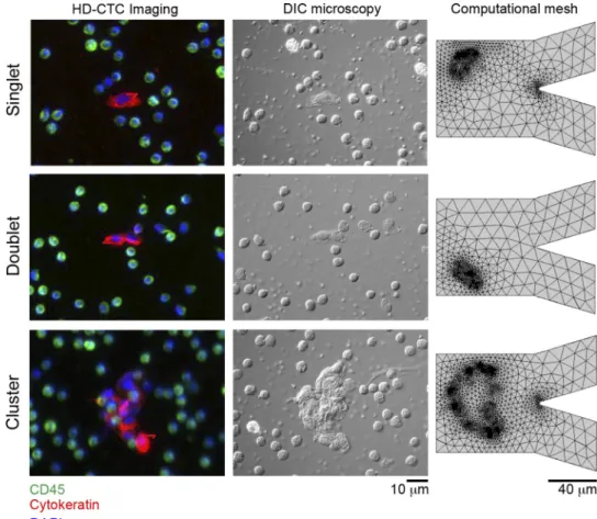 Fig. 4. Image segmentation for fluid dynam- dynam-ics simulations. CTCs are first identified  im-munofluorescently using the HD-CTC assay (left) and then imaged under differential  in-terference contrast to delineate the full  bor-ders of the cell (middle)