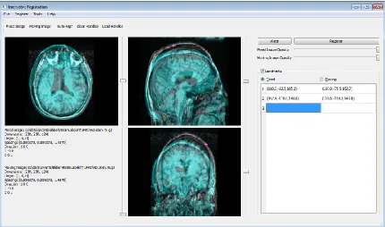 Figure 6.1 shows a snapshot of our prototype with two 3D MR images of brains being loaded