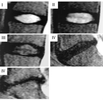 Figure 5: T2 correlations to T1ρ and Pfirrmann from Elliot Lab lumbar spine database collected over several years for a multitude of studies 