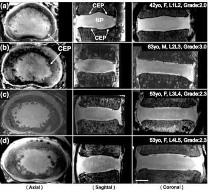 Figure 9: MRI images of four different specimens with 200 μm isotropic resolution acquired at 7T